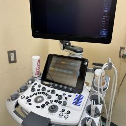超音波診断装置　日立　ARIETTA850